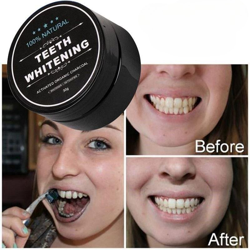 1 Box Activated Charcoal Teeth - đánh giá và giá Activated Charcoal Powder